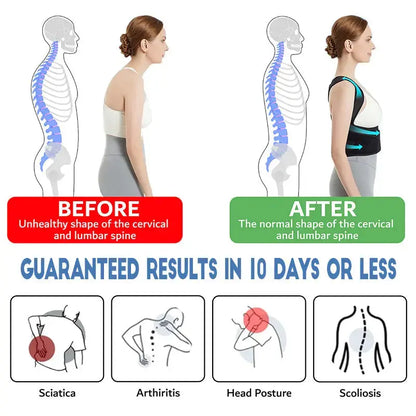 Instant Posture Corrector